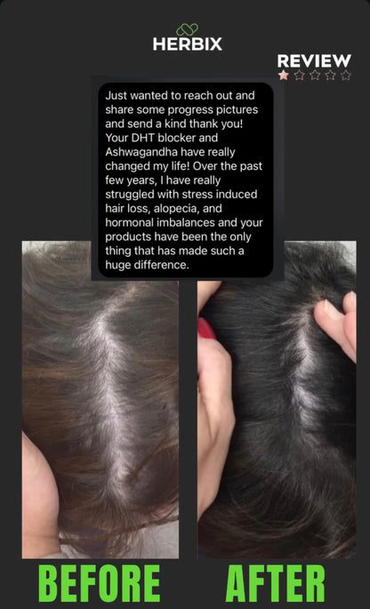 DHT Blocker (Hairloss)